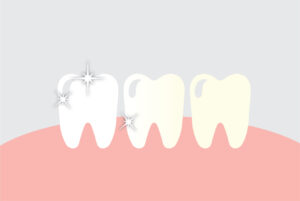 Teeth Whitening Illustration